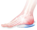 Plantar Fasciitis Heel Cups