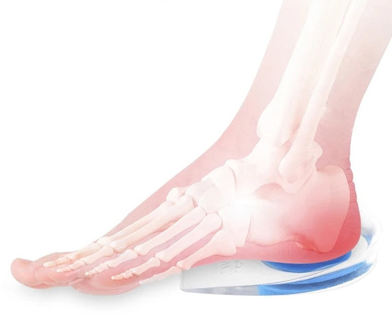 Plantar Fasciitis Heel Cups