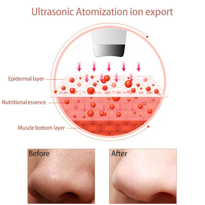 Ultrasonic Facial Skin Scrubber