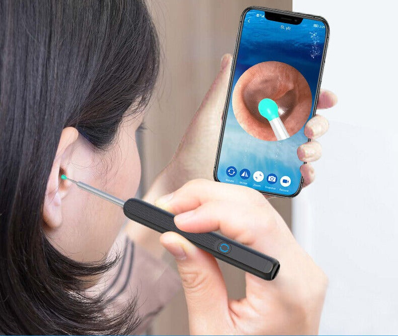 Smart ear wax cleaner for safe ear hygiene